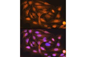 Immunofluorescence analysis of U-2 OS cells using ISG15 Rabbit mAb (ABIN7268023) at dilution of 1:100 (40x lens). (ISG15 抗体)