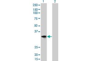 Western Blot analysis of CCND2 expression in transfected 293T cell line by CCND2 monoclonal antibody (M01), clone 3B10. (Cyclin D2 抗体  (AA 190-289))
