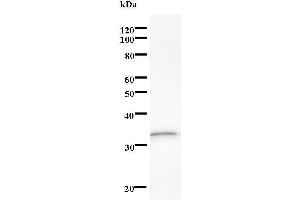 Western Blotting (WB) image for anti-DEAD (Asp-Glu-Ala-Asp) Box Polypeptide 17 (DDX17) antibody (ABIN933152) (DDX17 抗体)