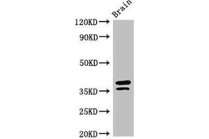 Western Blot Positive WB detected in: Mouse brain tissue All lanes: MAPRE2 antibody at 3 μg/mL Secondary Goat polyclonal to rabbit IgG at 1/50000 dilution Predicted band size: 38, 30, 36, 33, 31 kDa Observed band size: 38, 36 kDa (MAPRE2 抗体  (AA 159-240))