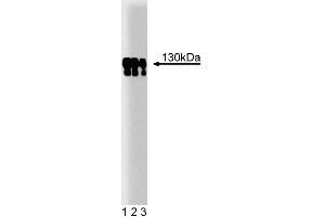 Western blot analysis of p130 [Cas] on a human endothelial cell lysate. (BCAR1 抗体  (AA 644-819))