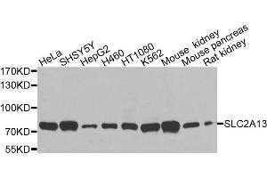 Western blot analysis of extracts of various cell lines, using SLC2A13 antibody (ABIN6003702) at 1/1000 dilution. (SLC2A13 抗体)