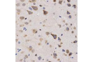 Immunohistochemistry (IHC) image for anti-Karyopherin (Importin) alpha 4 (KPNA4) (AA 1-240) antibody (ABIN3015855)