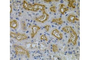 Immunohistochemistry of paraffin-embedded Mouse kidney using ERBB3 Polyclonal Antibody at dilution of 1:100 (40x lens). (ERBB3 抗体)