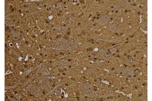 ABIN6264493 and ABIN6277542 at 1/100 staining Rat brain tissue by IHC-P.