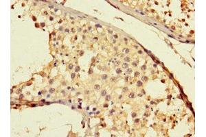 Immunohistochemistry of paraffin-embedded human testis tissue using ABIN7172144 at dilution of 1:100 (THADA 抗体  (AA 432-651))