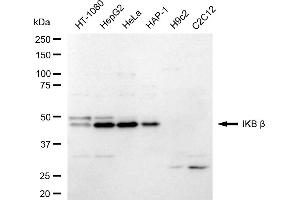 Western blotting analysis using IKB beta antibody (ABIN7799590).