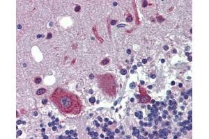 FEZF1 antibody was used for immunohistochemistry at a concentration of 4-8 ug/ml. (FEZF1 抗体  (C-Term))