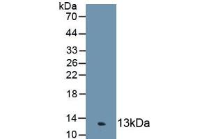 Western blot analysis of recombinant Human C4c. (Complement C4c 抗体  (AA 680-756))