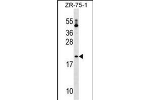 PTRH1 Antibody (Center) (ABIN1537717 and ABIN2849316) western blot analysis in ZR-75-1 cell line lysates (35 μg/lane). (PTRH1 抗体  (AA 102-129))