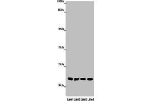 Western blot All lanes: ABHD14B antibody at 16 μg/mL Lane 1: Mouse small intestine tissue Lane 2: Mouse spleen tissue Lane 3: Mouse liver tissue Lane 4: Mouse lung tissue Secondary Goat polyclonal to rabbit IgG at 1/10000 dilution Predicted band size: 23, 19 kDa Observed band size: 23 kDa