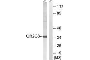 Western blot analysis of extracts from Jurkat cells, using OR2G3 Antibody. (OR2G3 抗体  (AA 61-110))