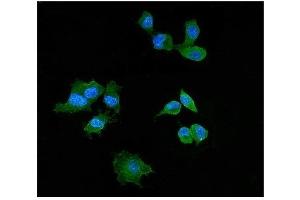 IF analysis of Elafin/Skalp using antiElafin/Skalp antibody (ABIN4886694). (PI3 抗体  (AA 61-117))