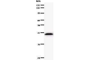 Western Blotting (WB) image for anti-Asparaginyl-tRNA Synthetase (NARS) antibody (ABIN932996) (NARS 抗体)