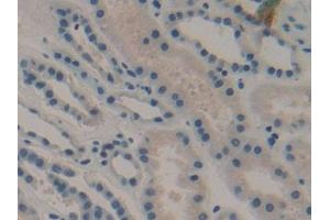 Detection of DKK1 in Human Kidney Tissue using Monoclonal Antibody to Dickkopf Related Protein 1 (DKK1) (DKK1 抗体  (AA 33-266))