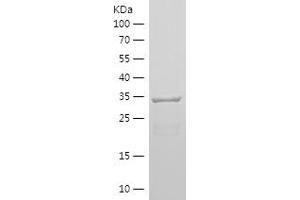 Western Blotting (WB) image for Nestin (NES) (AA 1036-1253) protein (His tag) (ABIN7124134) (Nestin Protein (NES) (AA 1036-1253) (His tag))