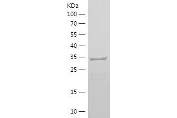 Nestin Protein (NES) (AA 1036-1253) (His tag)