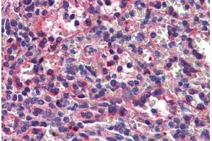 Human Spleen: Formalin-Fixed, Paraffin-Embedded (FFPE) (Septin 8 抗体  (AA 1-259))