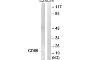 Western blot analysis of extracts from HuvEc cells, using CD69 Antibody.