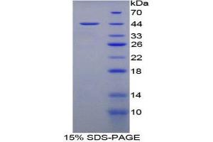 SDS-PAGE (SDS) image for Mucosae Associated Epithelia Chemokine (AA 29-131) protein (His tag,GST tag) (ABIN2123320)
