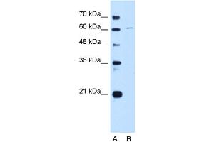 WB Suggested Anti-CDT1 Antibody Titration:  0. (CDT1 抗体  (C-Term))