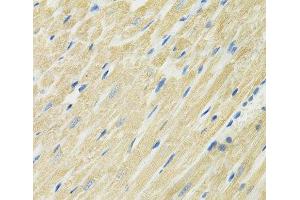 Immunohistochemistry of paraffin-embedded Rat heart using SLC19A1 Polyclonal Antibody at dilution of 1:100 (40x lens). (SLC19A1 抗体)