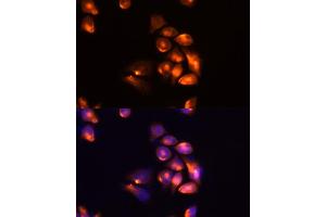 Immunofluorescence analysis of Hela cells using TIM-3/H antibody (ABIN6134185, ABIN6141626, ABIN6141630 and ABIN6217441) at dilution of 1:100 (40x lens).