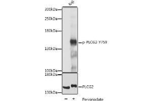 Western blot analysis of extracts of Raji cells, using Phospho-PLC gamma 2 (PLCG2)-Y759 antibody (ABIN7269341) at 1:2000 dilution or PLC gamma 2 (PLCG2) antibody (ABIN3023144, ABIN3023145, ABIN3023146 and ABIN6219411).