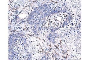 IHC analysis of CD93 using anti-CD93 antibody (ABIN7602865).