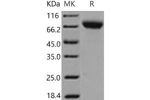 Western Blotting (WB) image for Intercellular Adhesion Molecule 1 (ICAM1) (Active) protein (His tag) (ABIN7196238) (ICAM1 Protein (His tag))