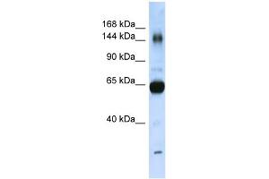 WB Suggested Anti-COL11A2 Antibody Titration:  0. (COL11A2 抗体  (N-Term))