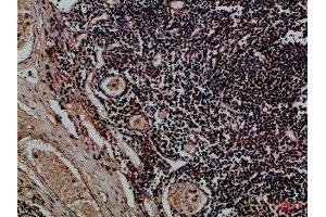 Immunohistochemical analysis of paraffin-embedded Human-tonsil, antibody was diluted at 1:100 (KIR2DL5A 抗体  (AA 31-80))