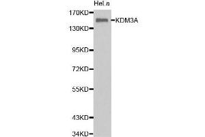 Western Blotting (WB) image for anti-Lysine (K)-Specific Demethylase 3A (KDM3A) (AA 1-300) antibody (ABIN6219489) (KDM3A 抗体  (AA 1-300))