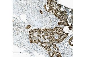 IHC analysis of PTBP2 using anti-PTBP2 antibody (ABIN7599453). (PTBP2 抗体  (AA 1-504))