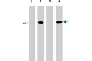 Western blot of A-431 cells untreated (lanes 1) or treated with pervanadate (lanes 2, 3 & 4).