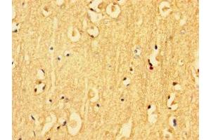 Immunohistochemistry of paraffin-embedded human brain tissue using ABIN7157217 at dilution of 1:100 (Kallikrein 6 抗体  (AA 22-244))