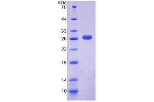 SDS-PAGE analysis of Mouse PEX1 Protein. (PEX1 蛋白)