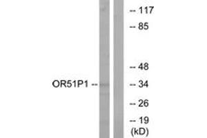 Western Blotting (WB) image for anti-Olfactory Receptor, Family 51, Subfamily D, Member 1 (OR51D1) (AA 33-82) antibody (ABIN1535922)