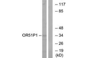 Western blot analysis of extracts from Jurkat cells, using OR51D1 Antibody. (OR51D1 抗体  (AA 33-82))