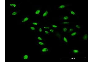 Immunofluorescence of purified MaxPab antibody to WDR4 on HeLa cell. (WDR4 抗体  (AA 1-412))