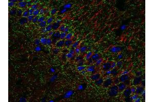 Indirect immunostaining of PFA fixed, paraffin embedded mouse hippocampus section with anti-β3 tubulin (dilution 1 : 500; red)and mouse anti-CB1 R (, dilution 1 : 500; green).