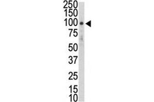 Western blot analysis of DDR2 antibody and HL-60 lysate. (DDR2 抗体  (AA 290-320))