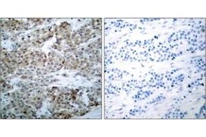 Immunohistochemistry (IHC) image for anti-BCL2-Associated Agonist of Cell Death (BAD) (AA 78-127), (pSer75) antibody (ABIN1531781)