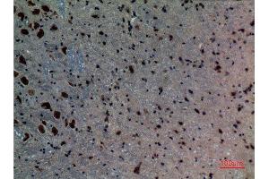 Immunohistochemistry (IHC) analysis of paraffin-embedded Mouse Brain, antibody was diluted at 1:100. (ACVRL1 抗体  (N-Term))