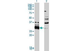 Western Blot analysis of HDGFRP3 expression in transfected 293T cell line by HDGFRP3 monoclonal antibody (M01), clone 2G12. (HDGFRP3 抗体  (AA 1-203))
