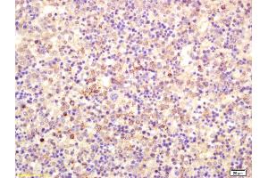 Immunohistochemistry (IHC) image for anti-Fc Fragment of IgE, Low Affinity II, Receptor For (CD23) (FCER2) (AA 221-321) antibody (ABIN741030)