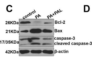 Effect of PAL on cell apoptosis in palmitate (PA) treated INS-1 cells. (Bcl-2 抗体)