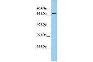 Host: Rabbit Target Name: BTBD18 Sample Type: 721_B Whole Cell lysates Antibody Dilution: 1. (BTBD18 抗体  (C-Term))