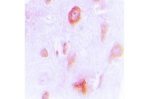 Immunohistochemistry (IHC) image for anti-Cytochrome P450, Family 4, Subfamily X, Polypeptide 1 (CYP4X1) (Center) antibody (ABIN7298608)