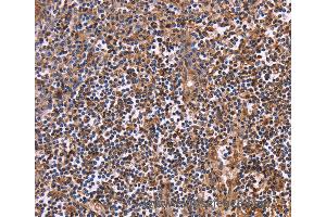 Immunohistochemistry of Human tonsil using CLUAP1 Polyclonal Antibody at dilution of 1:50 (CLUAP1 抗体)